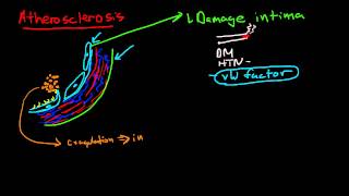 Pathophysiology of Atherosclerosis [upl. by Wenn]