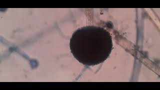 Fungus under Microscope Fungal structures Aspergillus [upl. by Annoj420]