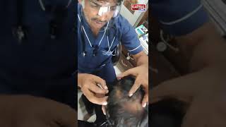 Hair fall problem Dr Mukhesh Agarwal  Video from Karnal Plus [upl. by Avah]