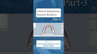 Clinical Indications Incisors Rotation Part 3 [upl. by Isiah354]