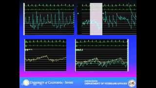 Cardiac Tamponade Case Vignette [upl. by Froehlich759]