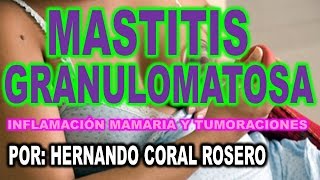 MASTITIS GRANULOMATOSA  INFLAMACIÓN MAMARIA Y TUMORACIONES [upl. by Suhploda]