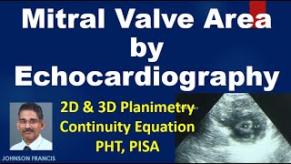 Assessment of Mitral Valve Area by Echo  3D Planimetry PHT PISA [upl. by Reviel]