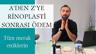 Burun Ameliyatı Sonrası Ödem [upl. by Zeiger]