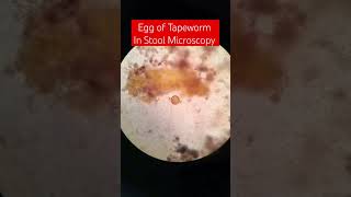 Egg of Human Parasite in Stool Microscopy  Taenia Tapeworm [upl. by Cohla]