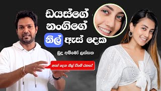 ඇස් දෙක නිල් වීමේ රහස  Dr Charitha Munasinghe [upl. by Dott]