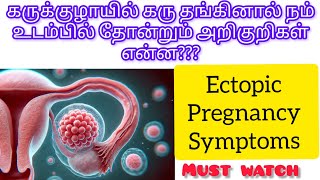 Ectopic pregnancy symptoms full explain in Tamilafter missed periods to start ectopicpregnancy [upl. by Otcefrep]