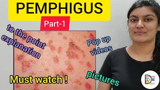 SKIN LESIONS PEMPHIGUS PART1 [upl. by Dunn]