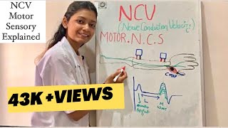 NCV test  Motor and sensory nerve conduction studies explained [upl. by Batsheva299]