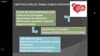 Sd de Uropatía obstructiva  clase 68  sem 13 [upl. by Yhtak]