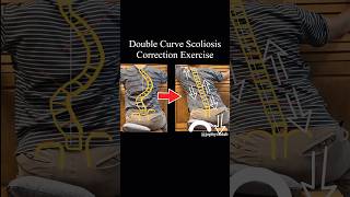 SCurve Scoliosis Correction Exercise Sshape Double curve [upl. by Ecirahc]