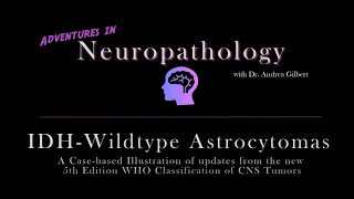 IDH  Wildtype Astrocytoma Update from the 5th Edition WHO Classification of CNS Tumors [upl. by Crosley]