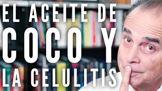 Episodio 219 Aceite De Coco Y La Celulitis [upl. by Ahselrak]