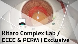 Kitaro Complex Lab Training Kit for Cataract surgery  ECCE amp PCRM  Exclusive  FCI Cataract [upl. by Swihart]