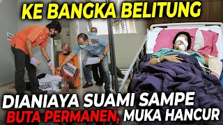 KEDUA MATA HANCUR WAJAH PENUH JAHITAN  SAYA BERTAHAN HANYA DEMI ANAK2 SAYA [upl. by Adnolat]