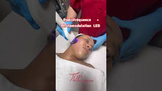 Radiofréquence visage  photomodulation LED 📣📣Radiofréquence By IMoos [upl. by Blount]