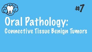 Oral Pathology  Connective Tissue Benign Tumors  INBDE ADAT [upl. by Malachi]