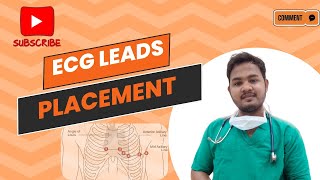 ECG Leads placement ECG electrode placement  EASY EXPLANATION ECG TYPES OF ECG LEADSecg [upl. by Akel747]