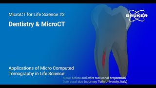 Dentistry amp MicroCT  Applications of MicroCT in Life Science 2 [upl. by Myrle732]