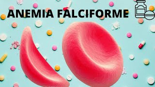 Anemia Falciforme [upl. by Ttenna]