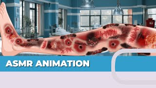 ASMR ANIMATION Cleaning the foot [upl. by Nivonod]