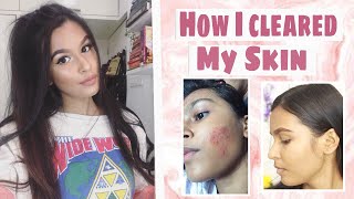 My Skincare Routine  Mridul Sharma [upl. by Angell253]