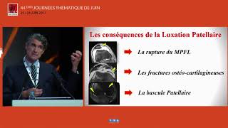 Dr David DEJOUR  LInstabilité patellaire objective  quel traitement [upl. by Elleron114]