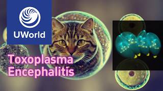 Toxoplasma gondii amp Toxoplasma encephalitis  UWorld USMLE Step 1 Question Nervous SystemNeurology [upl. by Alis]