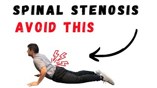 Spinal Stenosis core exercises for pain relief [upl. by Melda]