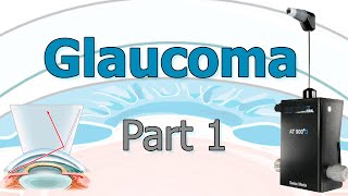 Glaucoma 1 Examen Clínico [upl. by Rangel]