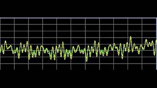 Nervous System Disorders  Rife Frequencies [upl. by Maillij]