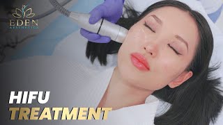 Revolutionize Your Skin HIFU Treatment at Dubais Top Aesthetic Clinic 2023 [upl. by Akemihs]