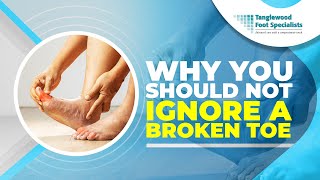 Why You Should Not Ignore a Broken Toe [upl. by Eybba152]