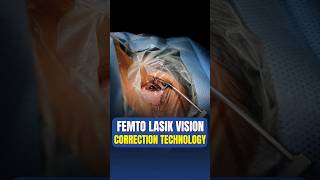 Live Femto Lasik Vision Correction Surgery [upl. by Osbourne]