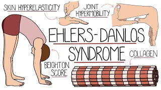 Ehlers Danlos Syndrome Explained Clearly [upl. by Enaerb405]