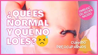 😵 Signos de ALARMA en el ombligo de un BEBÉ  ⚠️ ¿Cuándo consultar ¿Cómo cuidarlo 🔎 [upl. by Etnud]