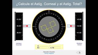 KERATOMETRY  QUERATOMETRIA  SESIÓN PRÁCTICA PPT [upl. by Frederic699]