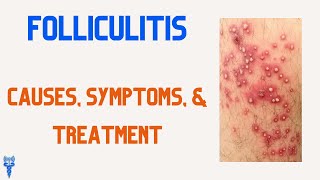 FOLLICULITIS Causes Symptoms amp Treatments [upl. by Llenreb]