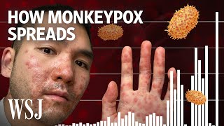 Why Monkeypox Is a Global Health Threat  WSJ [upl. by Nnyrat]