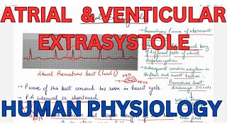 ATRIAL extrasystole Ventricular Extrasystole compensatory pause CVS [upl. by Kirad]