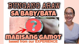 BUNGANG ARAW SA BABY o BATA  TREATMENT  GAMOT SA BUNGANG ARAW NG BABY  Let Galangco [upl. by Munmro]