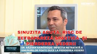 Sinuzita acută îți poate distruge viața Poate duce la orbire și la tetrapareza spastica [upl. by Goulette]