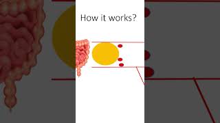 Dietary Cholesterol metabolism biochemistry stem cholesterol education metabolism [upl. by Namlak]