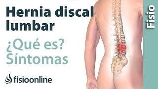 Hernia discal o de disco lumbar  Qué es causas síntomas y tratamiento [upl. by Airtemad]