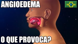 ANGIOEDEMA  Tenho Angioedema há meses e NINGUÉM EXPLICA o motivo [upl. by Retsub]