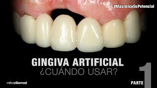 Gingiva Artificial ¿Cuándo usar  MaximiceSuPotencial  Milko Villarroel [upl. by Kared]