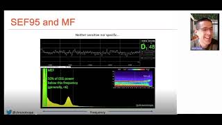 Processed EEG in anaesthesia [upl. by Gustav]