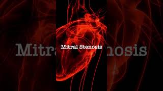 Normal vs Mitral Stenosis [upl. by Devondra]