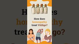 How does homeopathy treat Vitiligo By Dr Rajesh Shah MD Hom Life Force Homeopathy homeopathy [upl. by Namielus54]