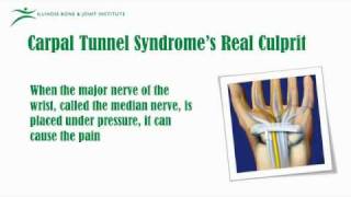 Managing Life With Carpal Tunnel [upl. by Jeannie]